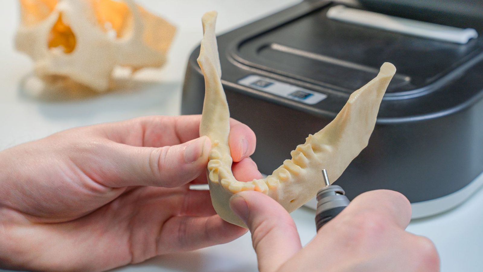 Detailansicht eines 3D-gedruckten Zahnmodells, das von einem Techniker in einem Labor nachbearbeitet wird